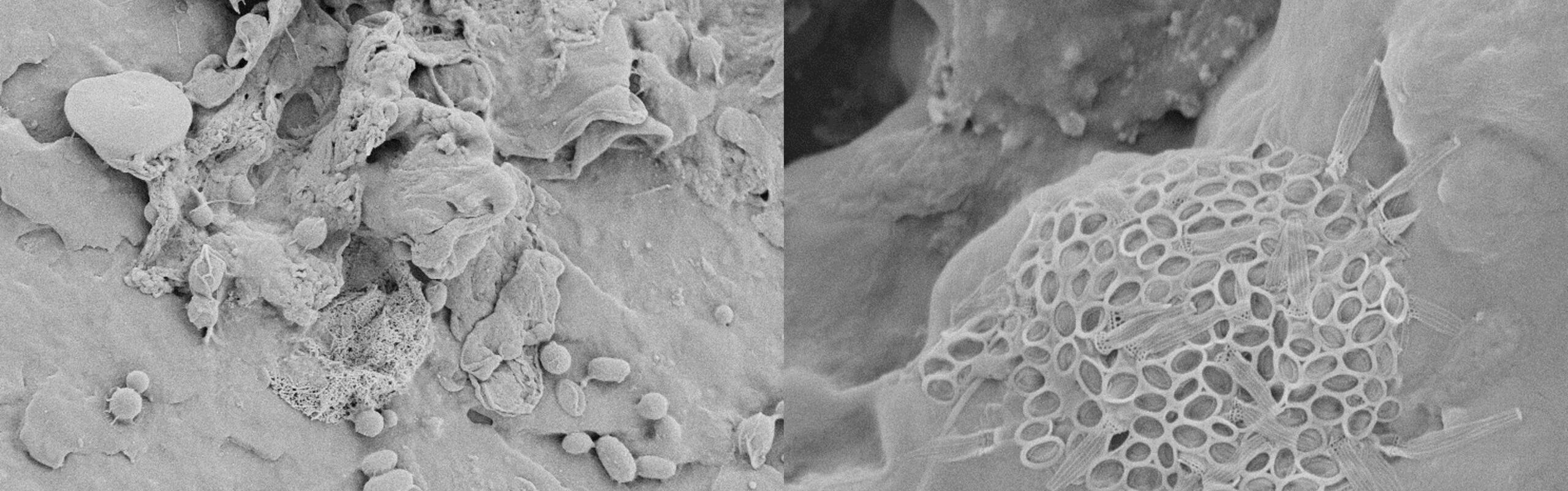 Biofilm auf Mikroplastik