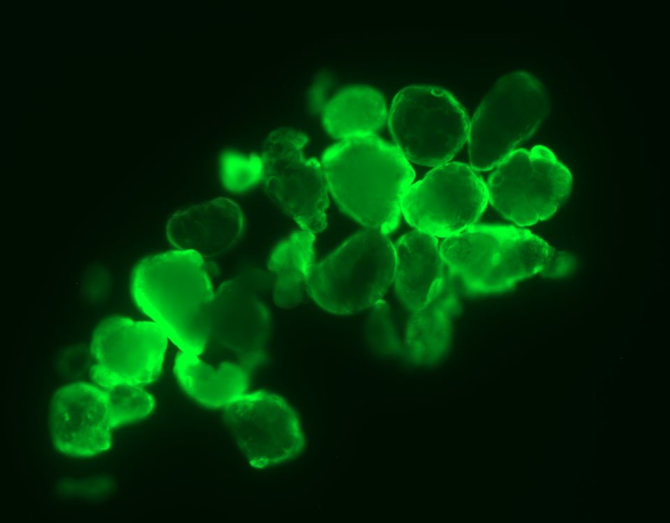 Polyethylen grüne Fluoreszenz: Mikroplastik detektieren kann so einfach und kostengünstig sein